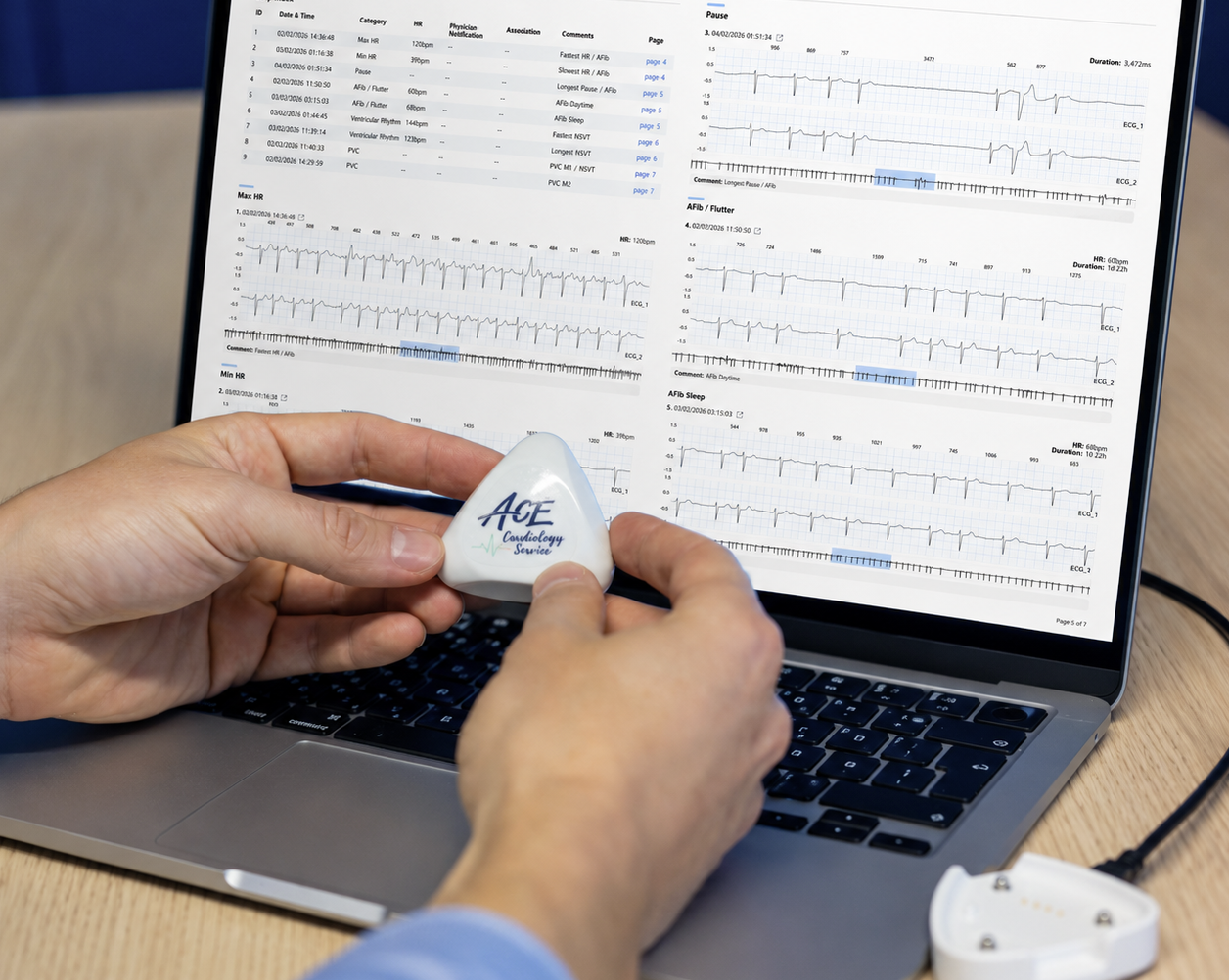 Cardiologist reviewing ECG data on laptop